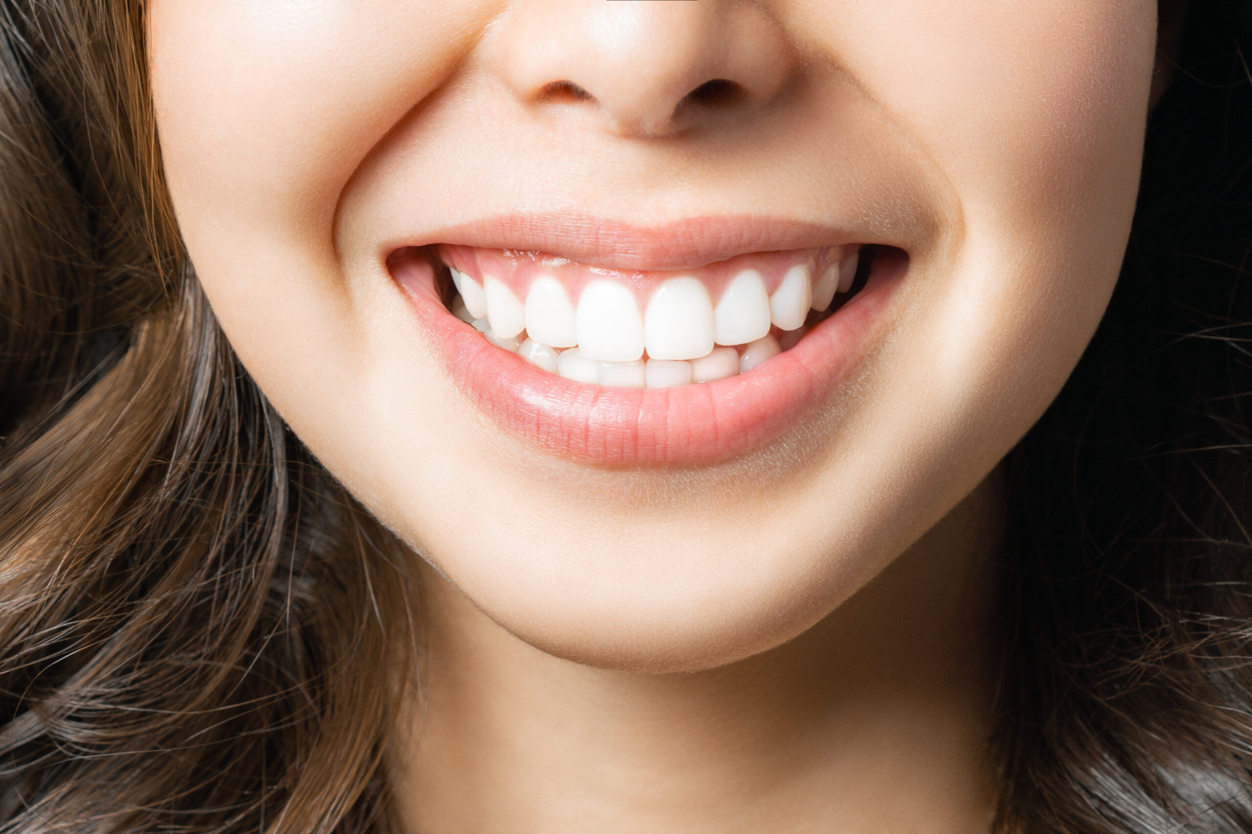 Close-up of young woman smiling showing perfect white teeth.