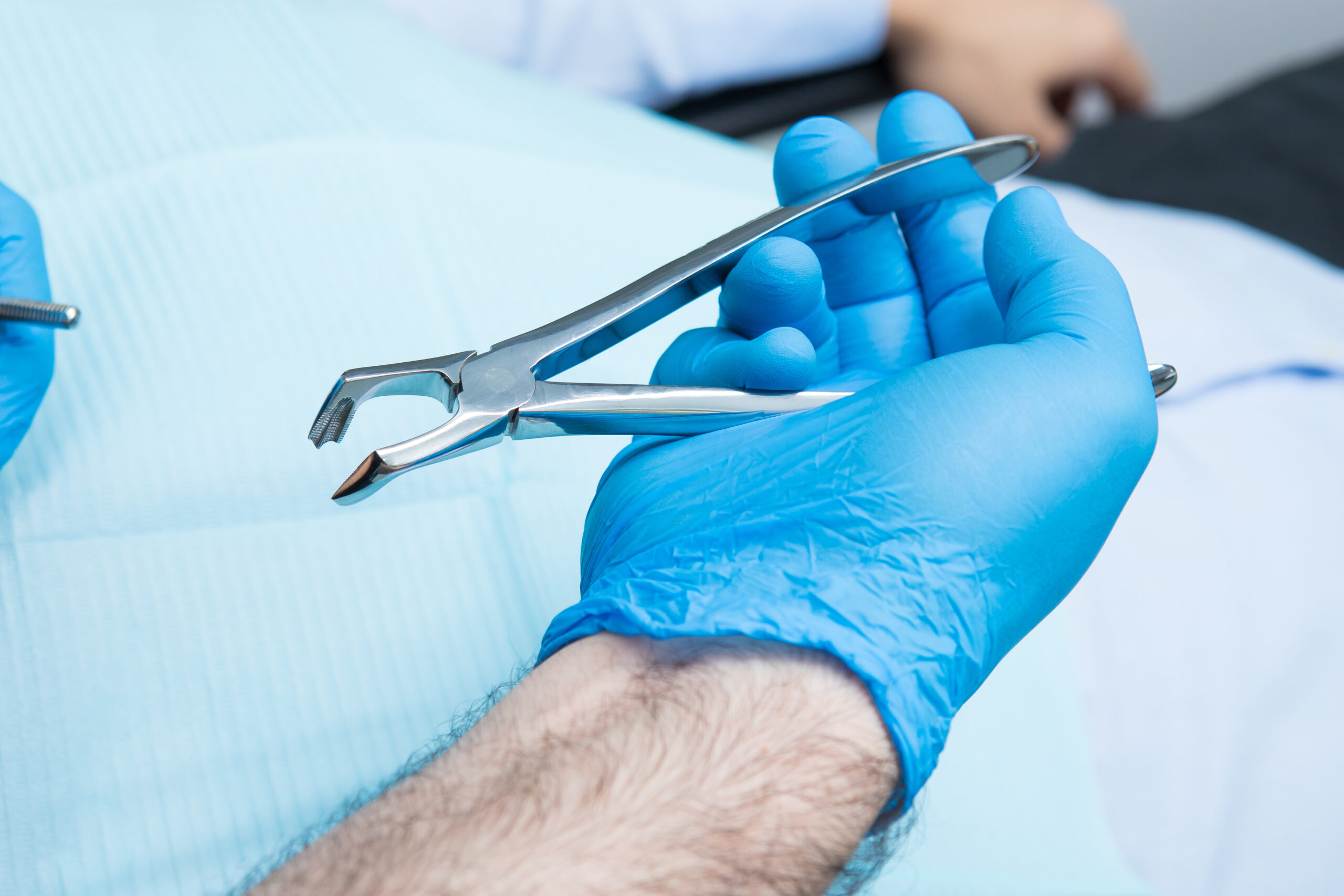 Dentist holding forceps, preparing for tooth extraction.